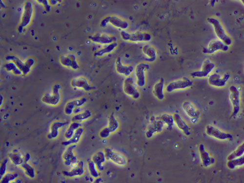 Інфекція Naegleria Fowleri (амеба, що їсть мозок) Інфекція Naegleria Fowleri (амеба, що їсть мозок)