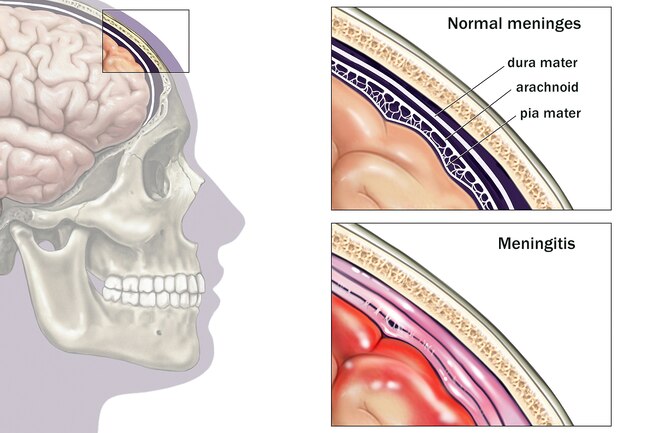 https://medukr.org/wp-content/uploads/2020/12/1800ss_medicalimages_rm_brain_meninges_illustration.jpg