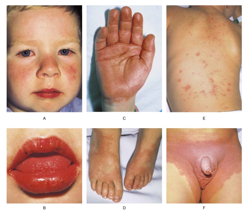 https://medukr.org/wp-content/uploads/2020/12/nejm199511233332105_f1.jpeg
