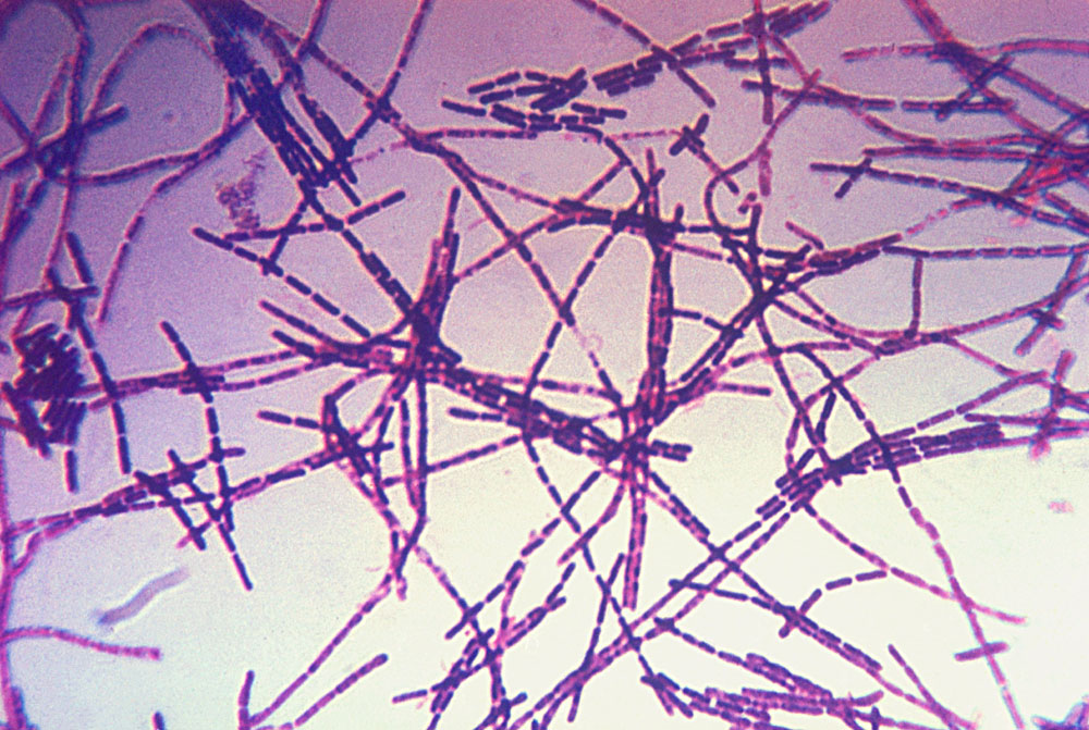 Бактерія Bacillus anthracis