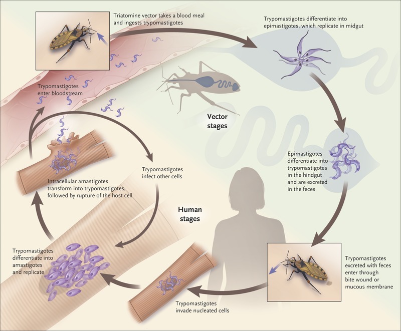 https://medukr.org/wp-content/uploads/2021/01/nejmra1410150_f1.jpeg